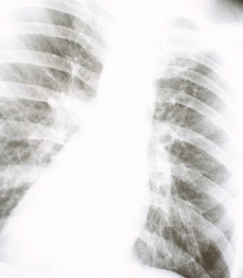 長期的な乱心は癌や難病に発展する4b